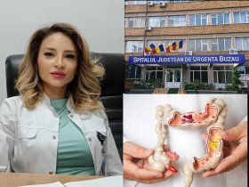 Prevenția salvează vieți ! Cancerul colorectal: cauze, simptome, tratament
