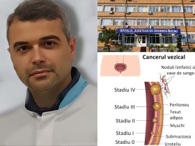 Cancerul de vezică urinară