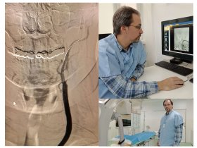 Premieră medicală în radiologie intervențională la SJU Buzău