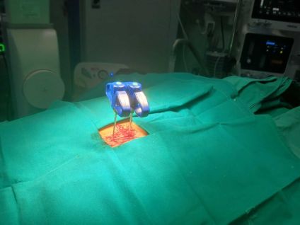 Vertebroplastie percutanăIntervenție neurochirurgicală în premieră la SJU Buzău